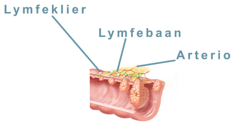 Lymfeklier